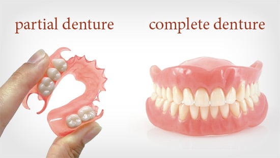 Full Denture and Partial Denture
