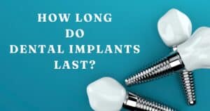 how long do dental implants last