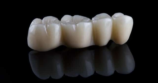 Dental Crowns Explained: Restoring Your Smile’s Strength And Beauty