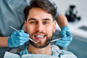 Braces in Missouri City
